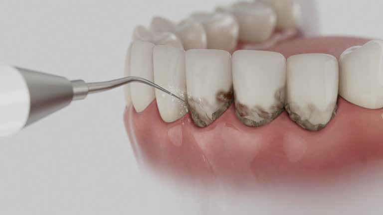 Trusted Invisalign Clear Aligners service in Lonoke, AR - Dentist Open Now